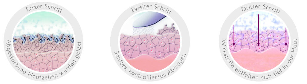 MDA schritte