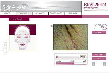 skinalyzer med7-falten